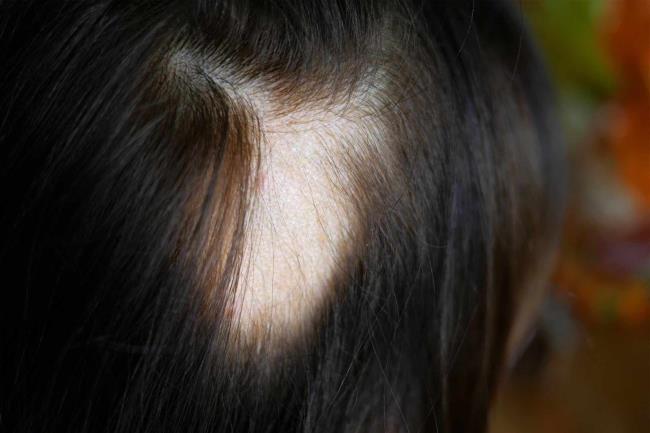 20-facts-a<em></em>bout-barakat-syndrome